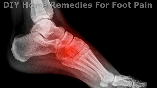 DIY Home Remedies For Foot Pain